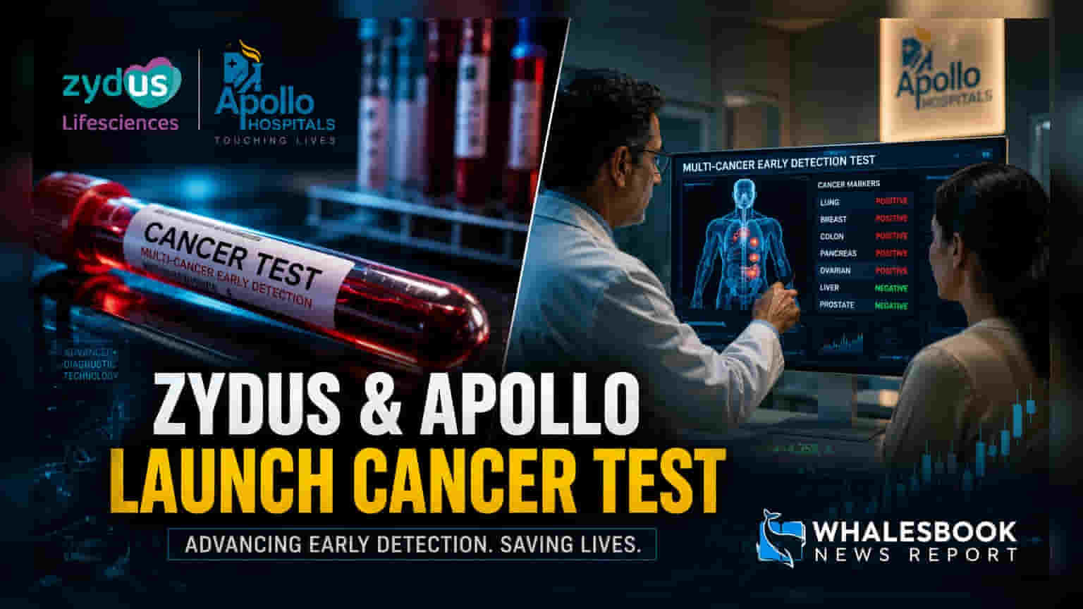 Zydus Lifesciences અને Apollo Hospitalsનો હાથ મિલાવીને કેન્સર ટેસ્ટ લોન્ચ, રોકાણકારોની નજર તેજી પર